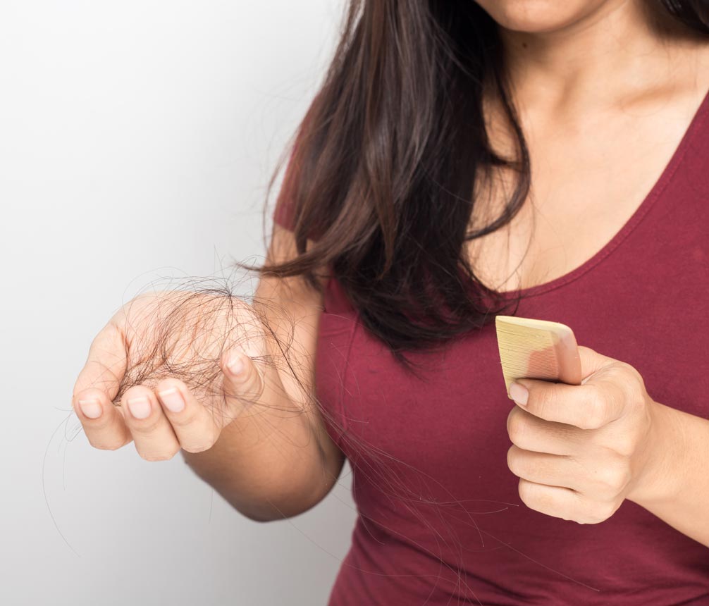 Biotin Deficiency Can Cause Hair Loss Different medical conditions and drugs can cause biotin deficiency and lead to hair loss.