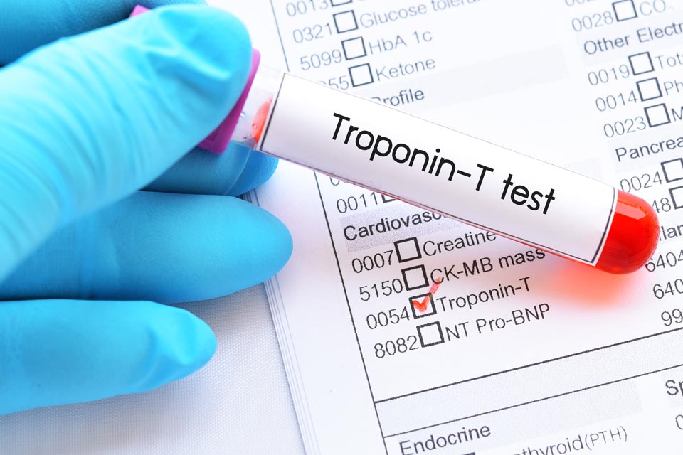 Biotin & Lab Tests Biotin is known to interfere with certain lab tests, including a dangerous interference with tests for troponin.