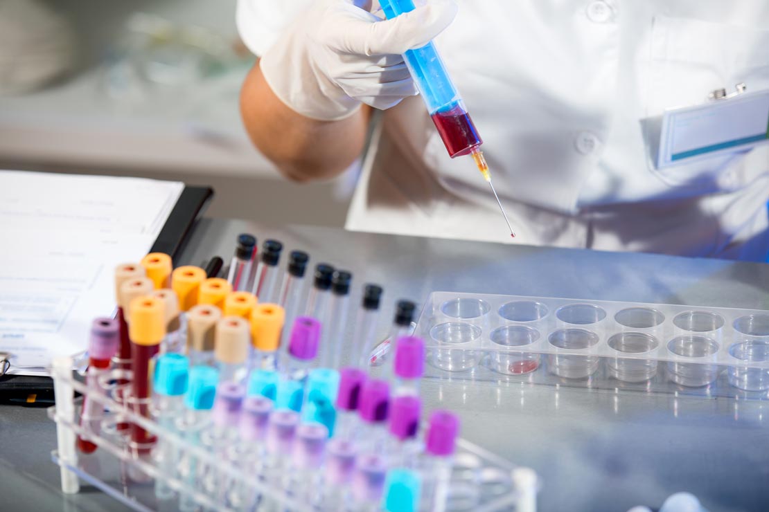 Biotinylated Diagostic Tests Which diagnostic tests are biotin and avidin used in?