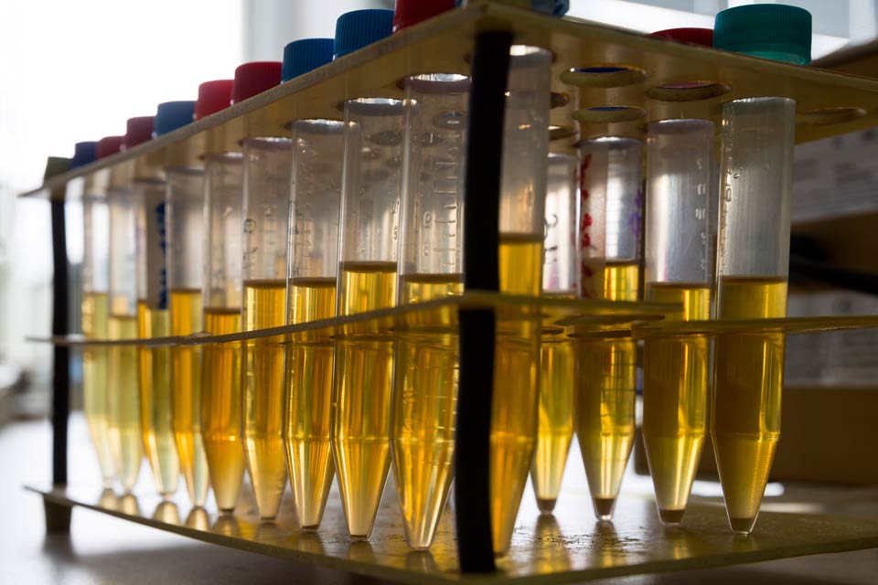 The best tests for biotin levels are done on urine samples.